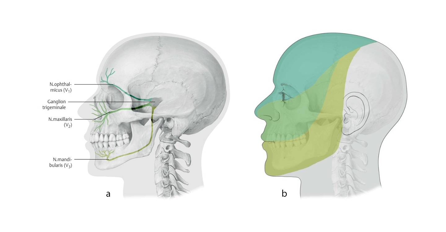 Medizinische Darstellung des Kopfes - Trigeminusneuralgie