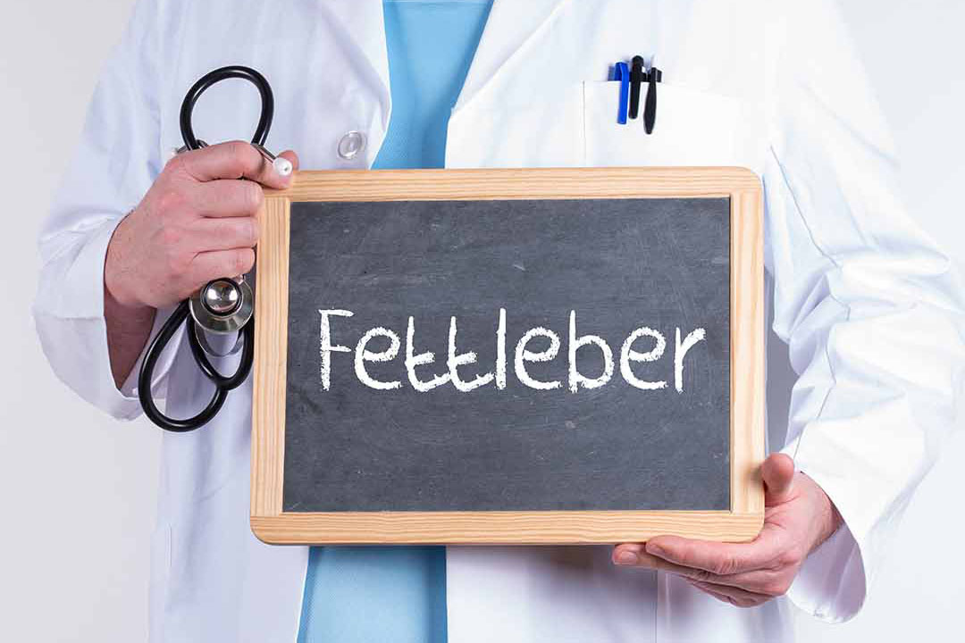 Arzt im weissen Kittel mit Stethoskop und einer Tagel mit Aufschrift Fettleber