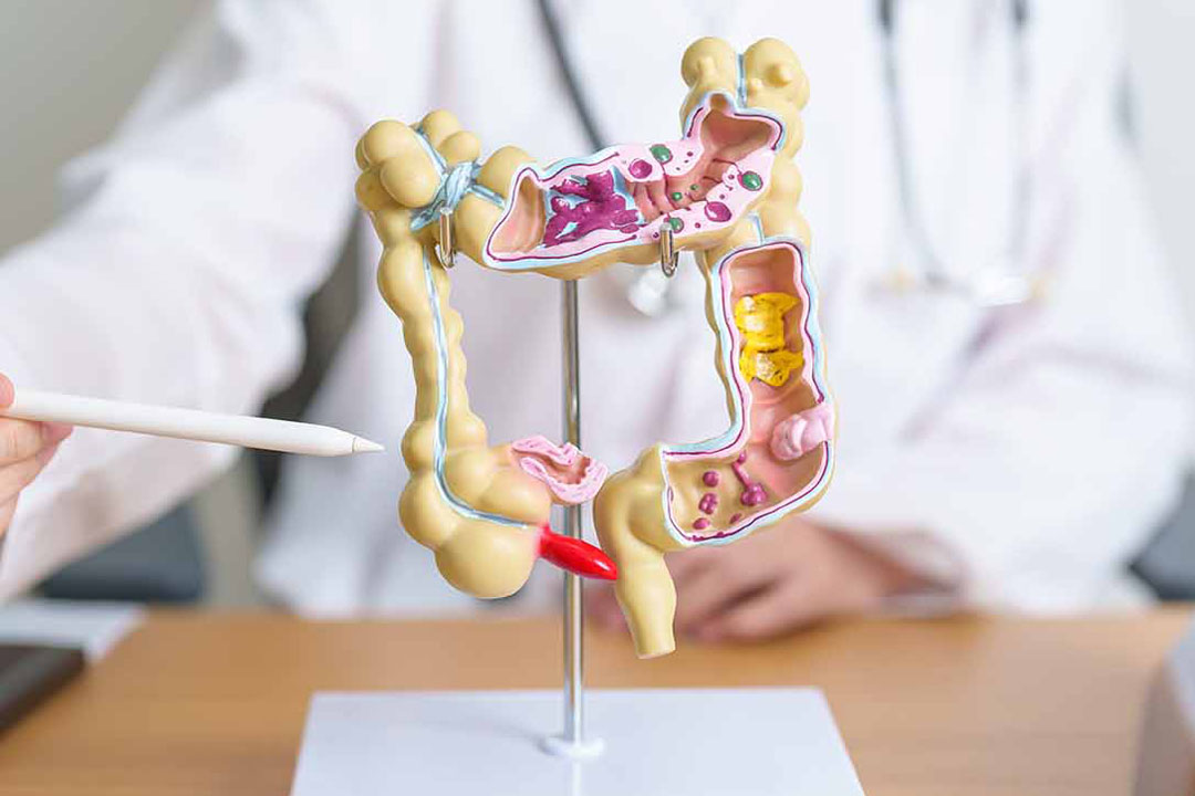 Arzt mit einem Darm Modell zeigt mit Stift darauf