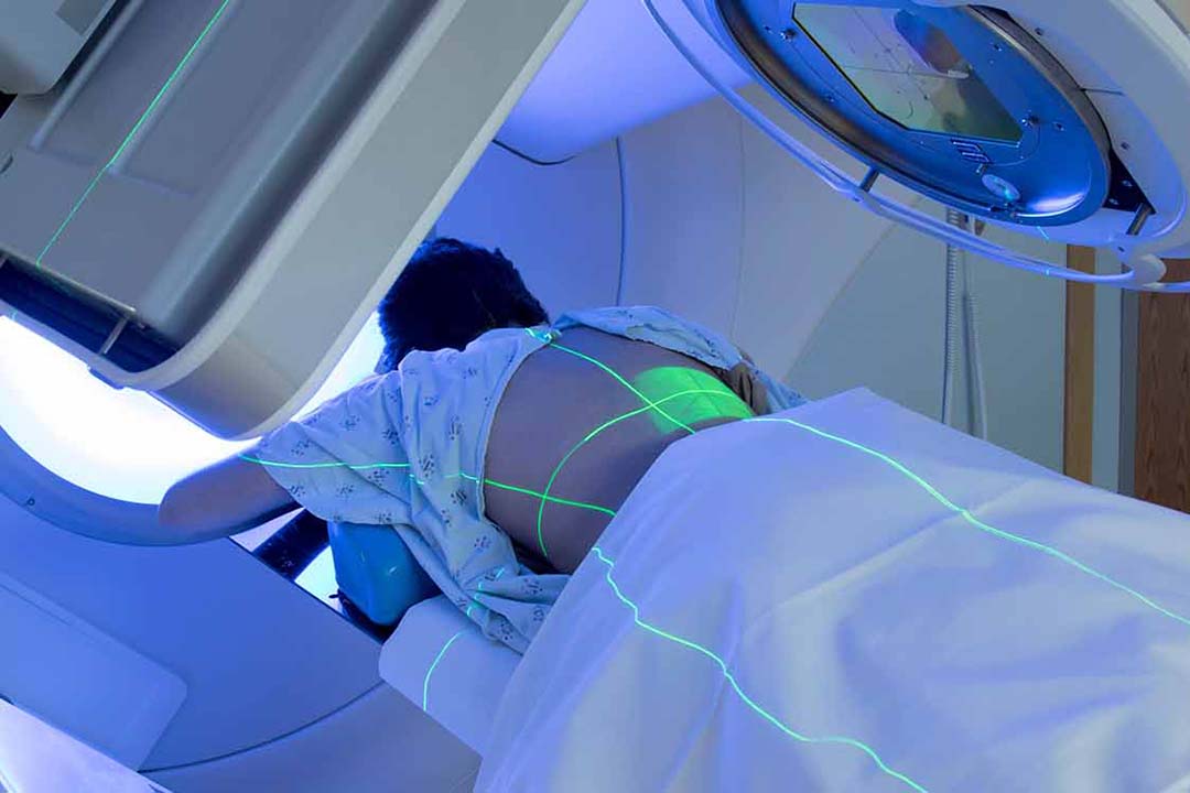 Mann auf einer Liege ueber ihm das Strahlengerät