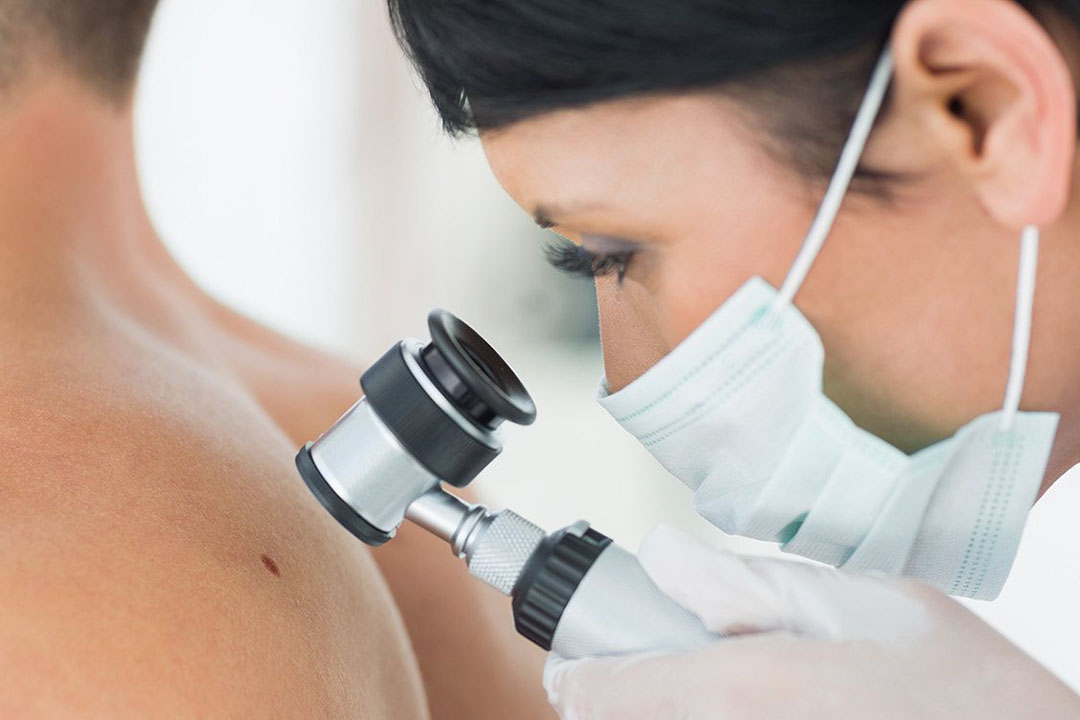 Ärztin untersucht den Leberfleck am Rücken eines Patienten