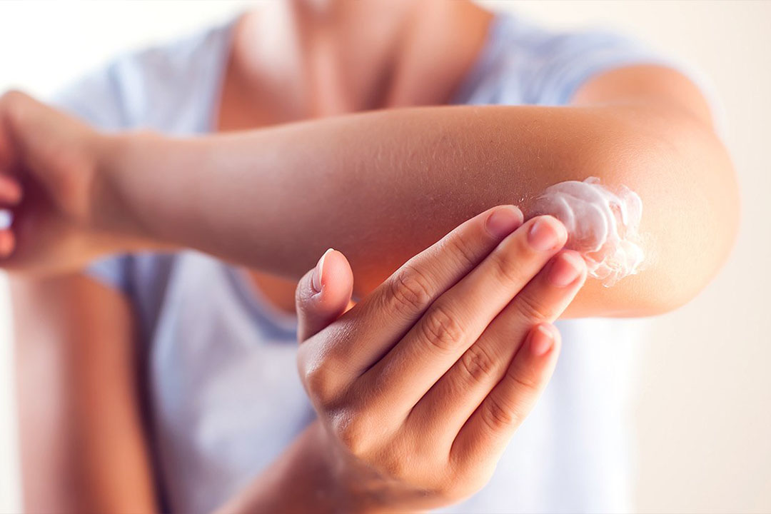 Nahaufnahme - Ellenbogen wird eingecremt