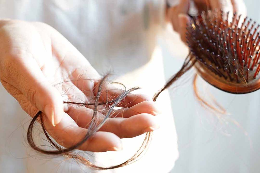 Eine Nahaufnahme einer Hand die ausgefallene Haare aus einer Haarbürste hält