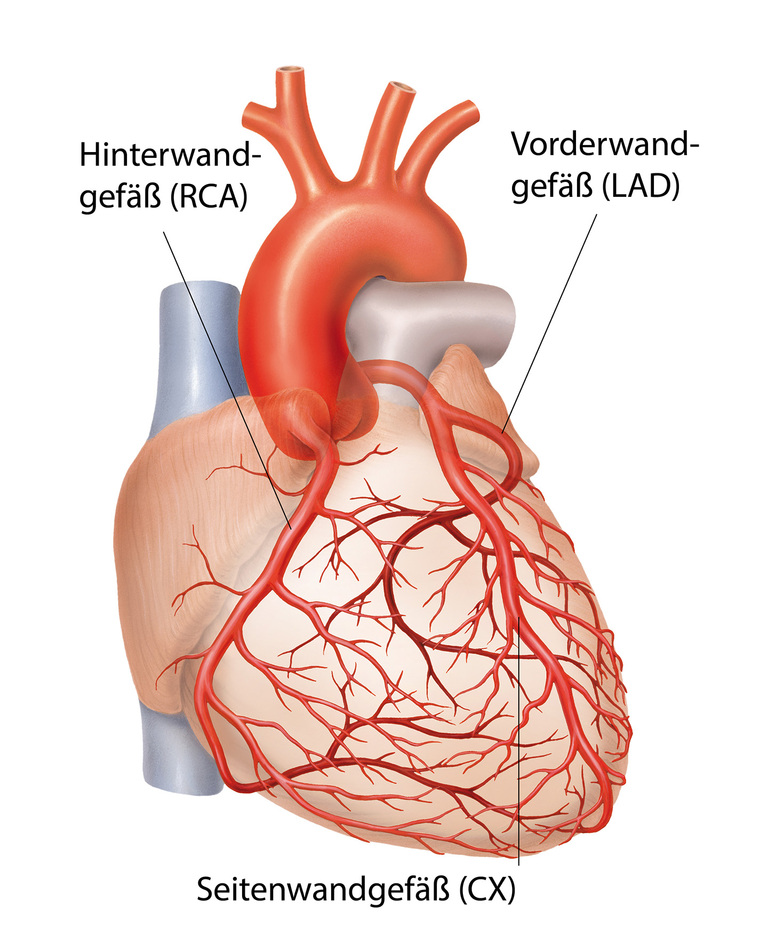 Grafik eines Herz mit den Arterien und Venen